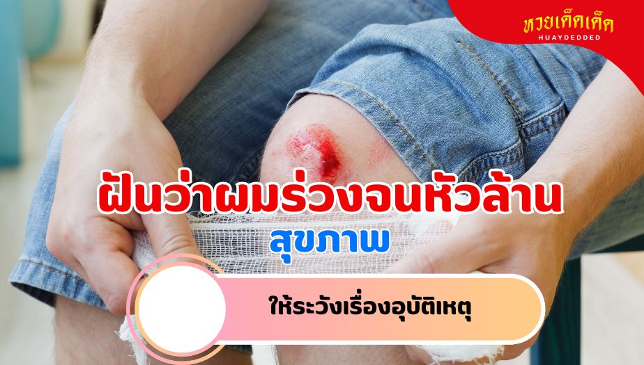 ฝันว่าผมร่วงจนหัวล้าน วิเคราะห์ความฝัน เรื่องสุขภาพ