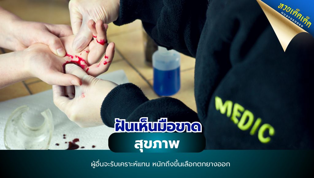 ฝันเห็นมือขาด ทำนายฝัน ด้านสุขภาพ