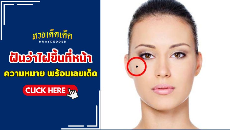 ฝันว่าไฝขึ้นที่หน้า หมายถึงการได้รับโอกาสในงาน โชคทางการเงิน และความสมหวังในความรัก