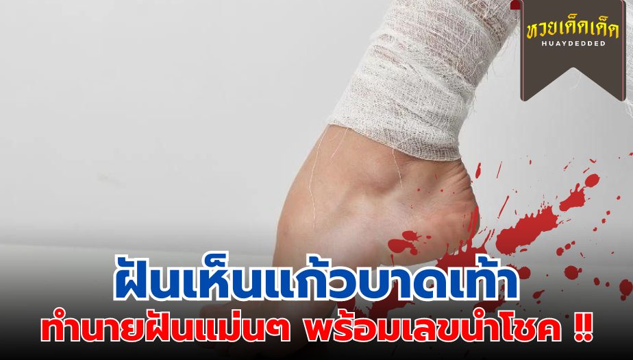 ฝันเห็นแก้วบาดเท้า ความหมายสื่อว่าอย่างไร จะโชคดีหรือไม่ ? เช็กด่วน