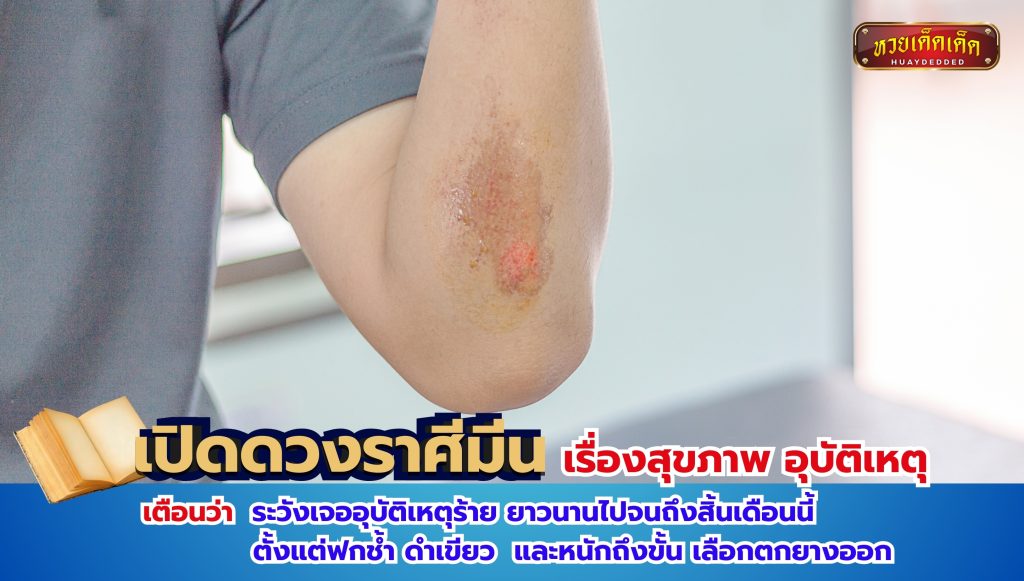 เปิดดวงราศีมีน เรื่องสุขภาพ อุบัติเหตุ คำทำนาย ดังนี้